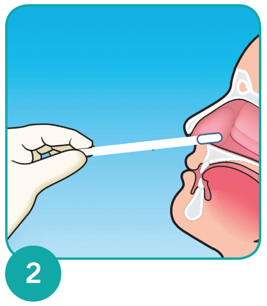 Step 2. Head postiion.